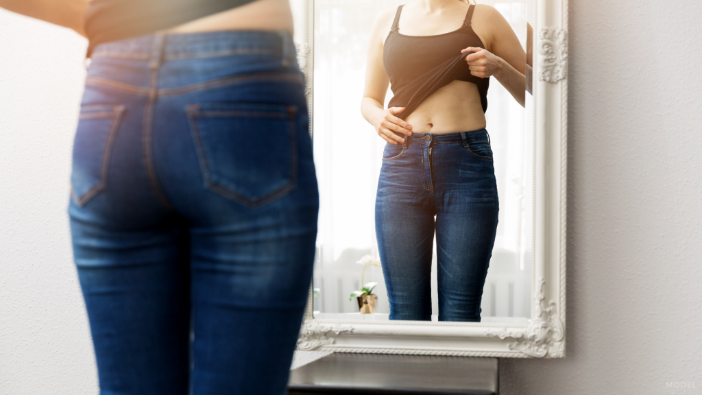 Woman after weight loss considering CoolSculpting in Tucson, AZ