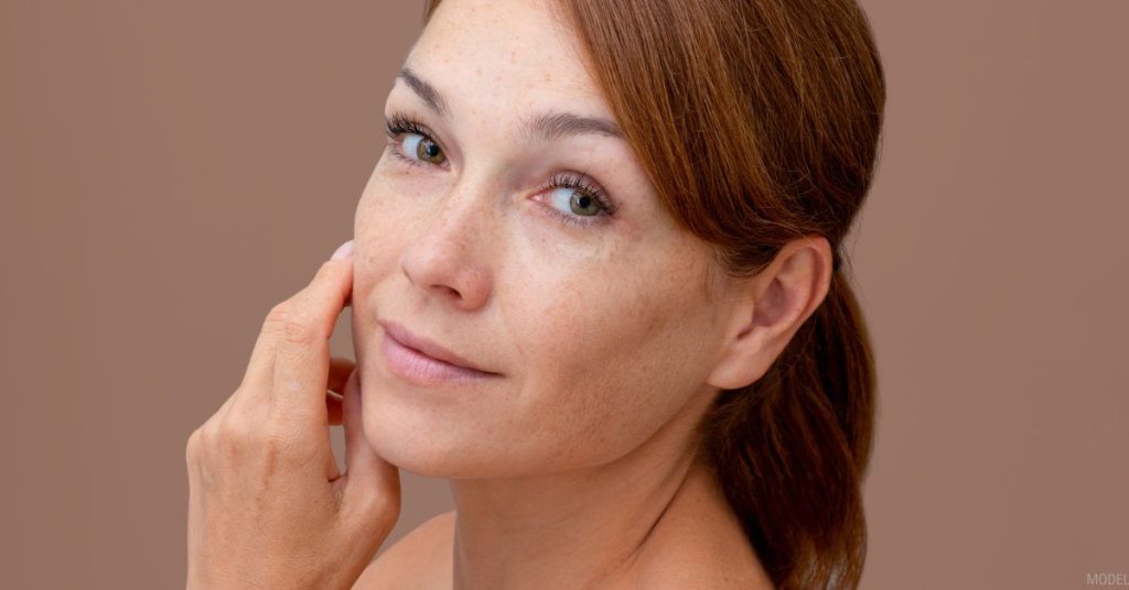 Woman with freckled skin touching her face (model)